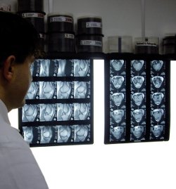 Consulenza di personale sanitario ad alta specializzazione cardiaca, vascolare e chirurgica